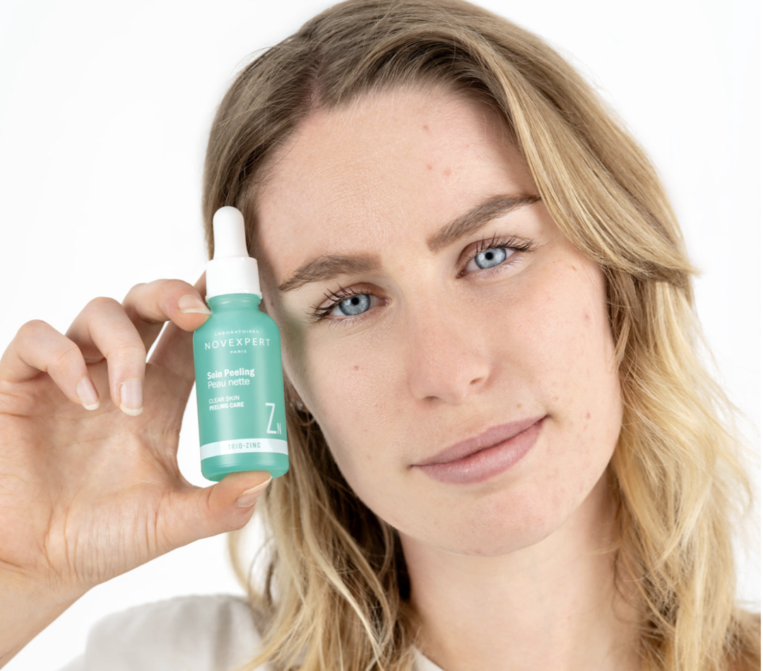 Rutina Natural Piel Grasa Acne