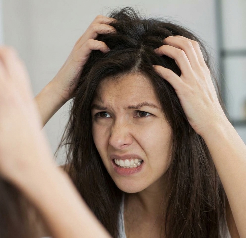 Guia contra la descamacion con productos naturales